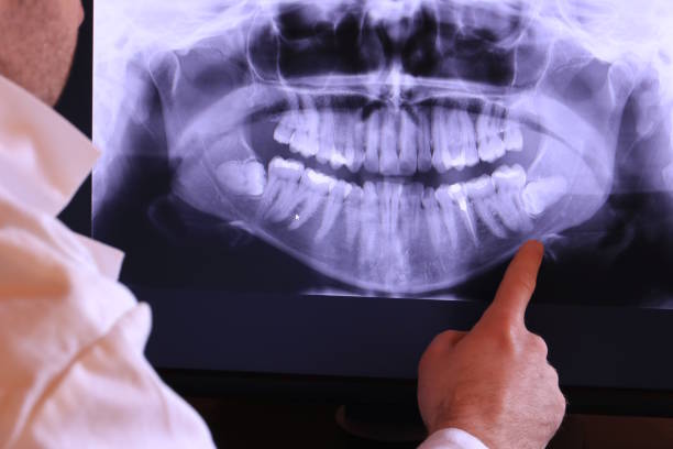 Best Emergency Broken Tooth Repair in Four Square Mile, CO