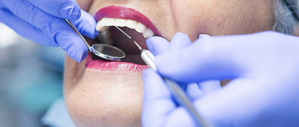 Best Same-Day Emergency Dentist in Four Square Mile, CO
